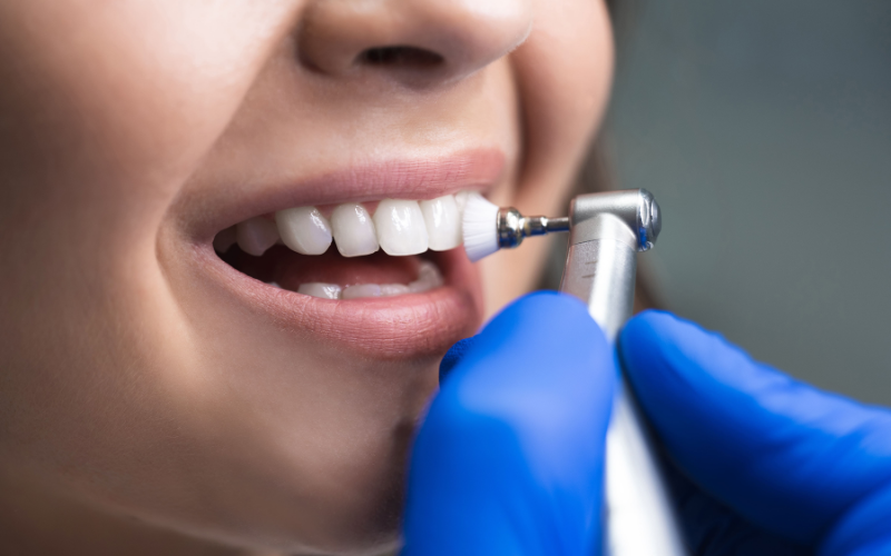 Why Kids Need Dental Cleanings and Exams