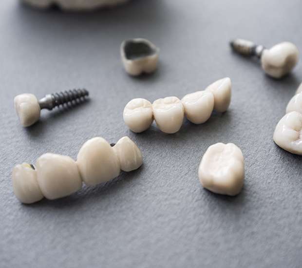 Albany The Difference Between Dental Implants and Mini Dental Implants